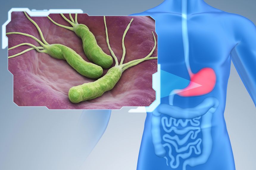 Helikobakter pylori ilustrace, léčba Helikobakter pylori, masticha a helikobakter